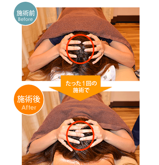 1回の施術で頭部のサイズに変化が出ていることが分かります。
